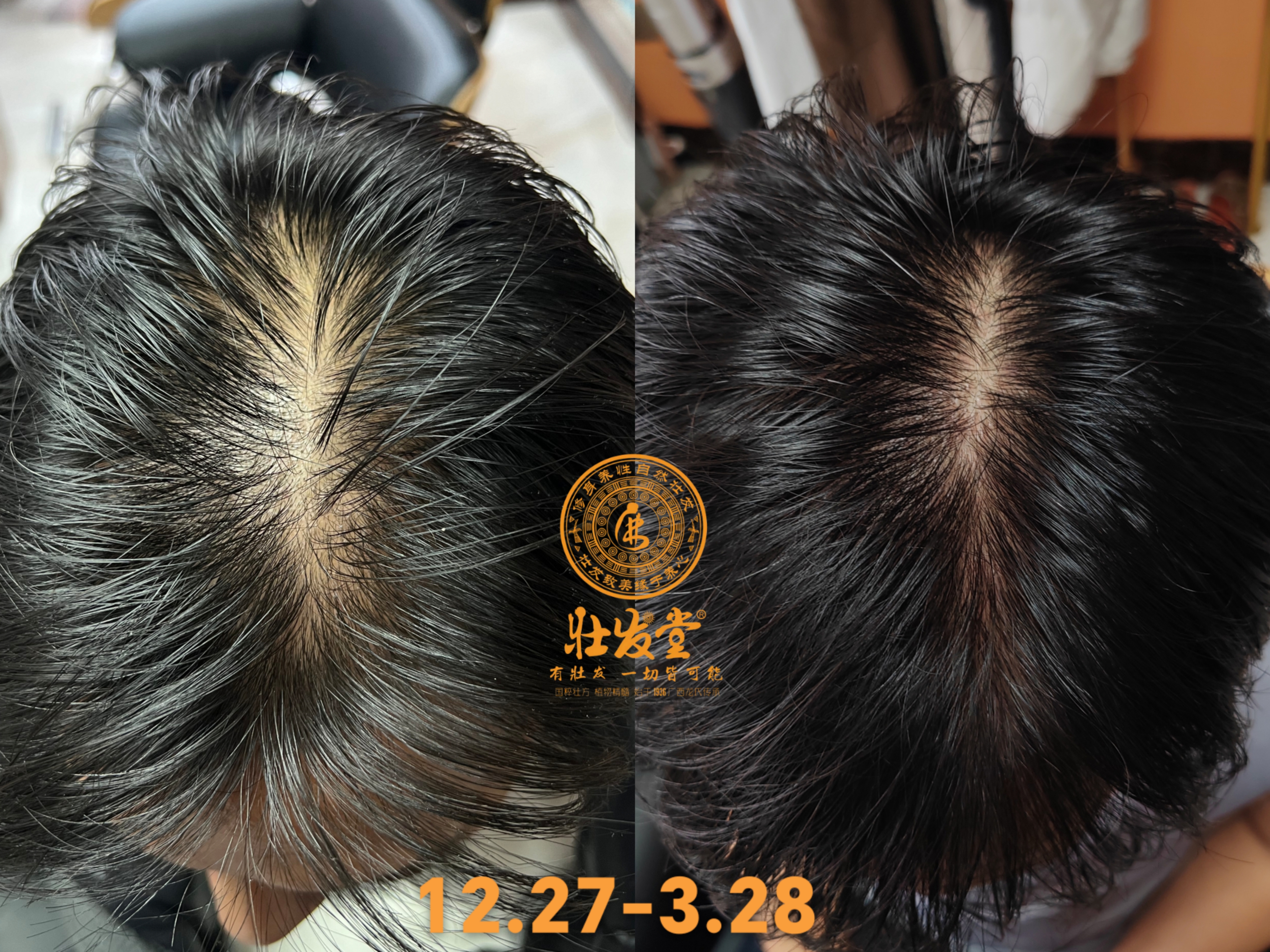 发缝逐渐在减小