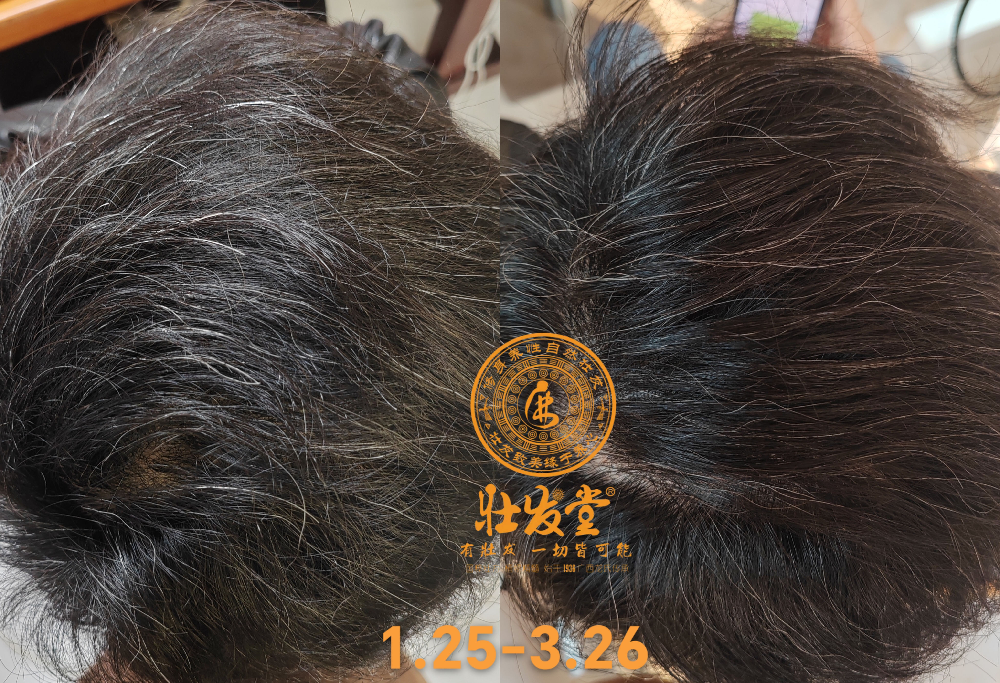 头发越来越乌黑亮泽